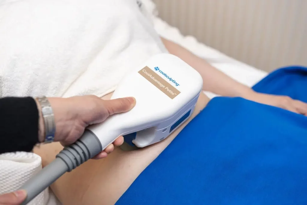 Coolsculpting Elite Allure Dermatology in Edinburg TX