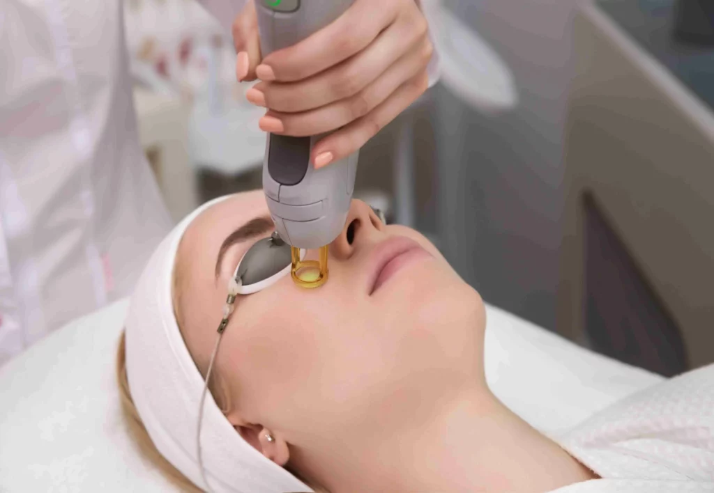 a woman receiving a laser treatment on face | Allure Dermatology | Edinburg, TX