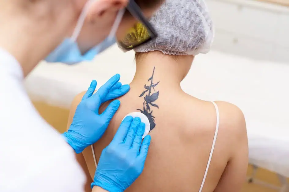 Tattoo Removal by Allure Dermatology P.A. LLC in Edinburg TX