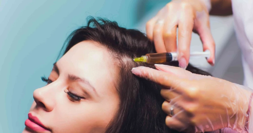 A woman receives PRP therapy as a professional injects platelet-rich plasma into her scalp to promote hair growth in Edinburg TX