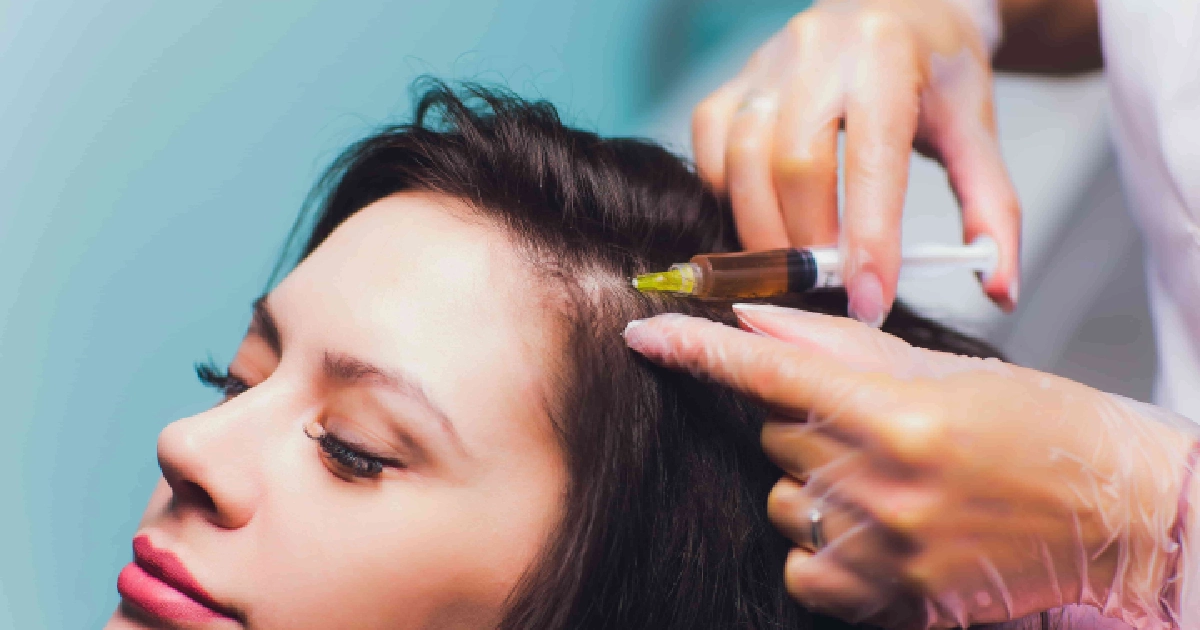 A woman receives PRP therapy as a professional injects platelet-rich plasma into her scalp to promote hair growth in Edinburg TX
