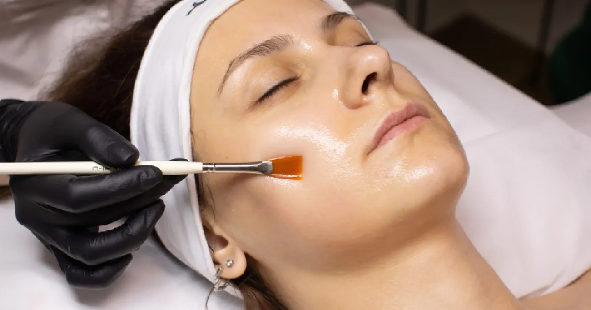 Women receiving Chemical Peels in Edinburg TX