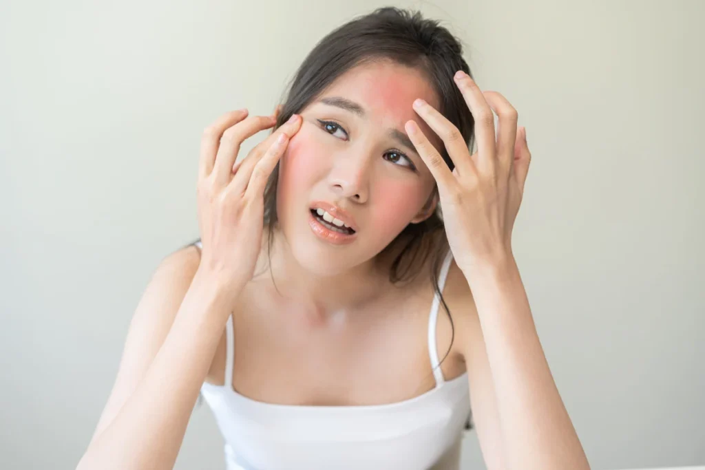 Woman receiving Laser Excel V for redness in Edinburg TX Allure Dermatology P.A.