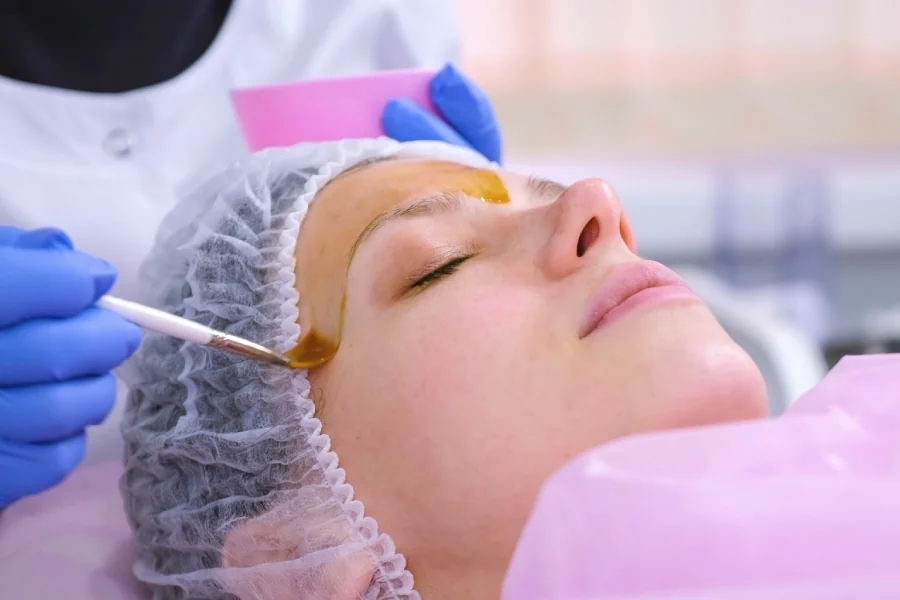 Chemical peels application on woman's face | Allure Dermatology | Edinburg, TX